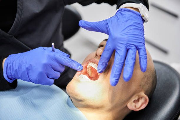Best Emergency Tooth Extraction in Ackerman, MS